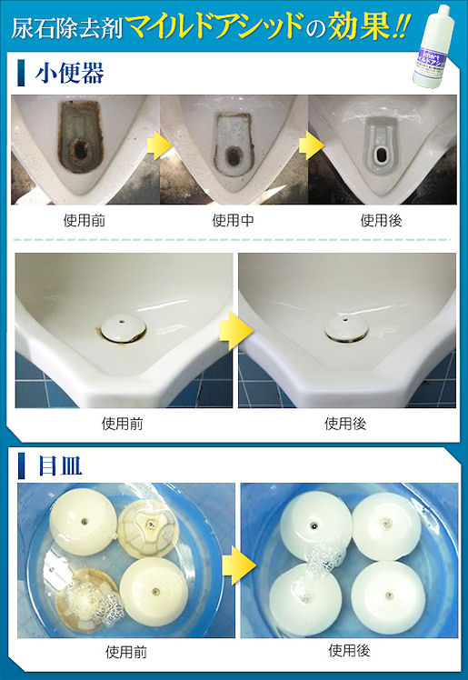 �A�΂ƃX�P�[���̏����܁E�}�C���h�A�V�b�h�̎g�p���@